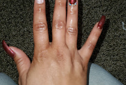 Nail Trap